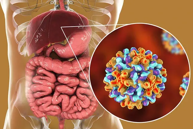 Husband and Wife Shocked After Both Were Diagnosed With Li.ver Can.cer: Doctors Point to a Common “Money-Saving” Habit