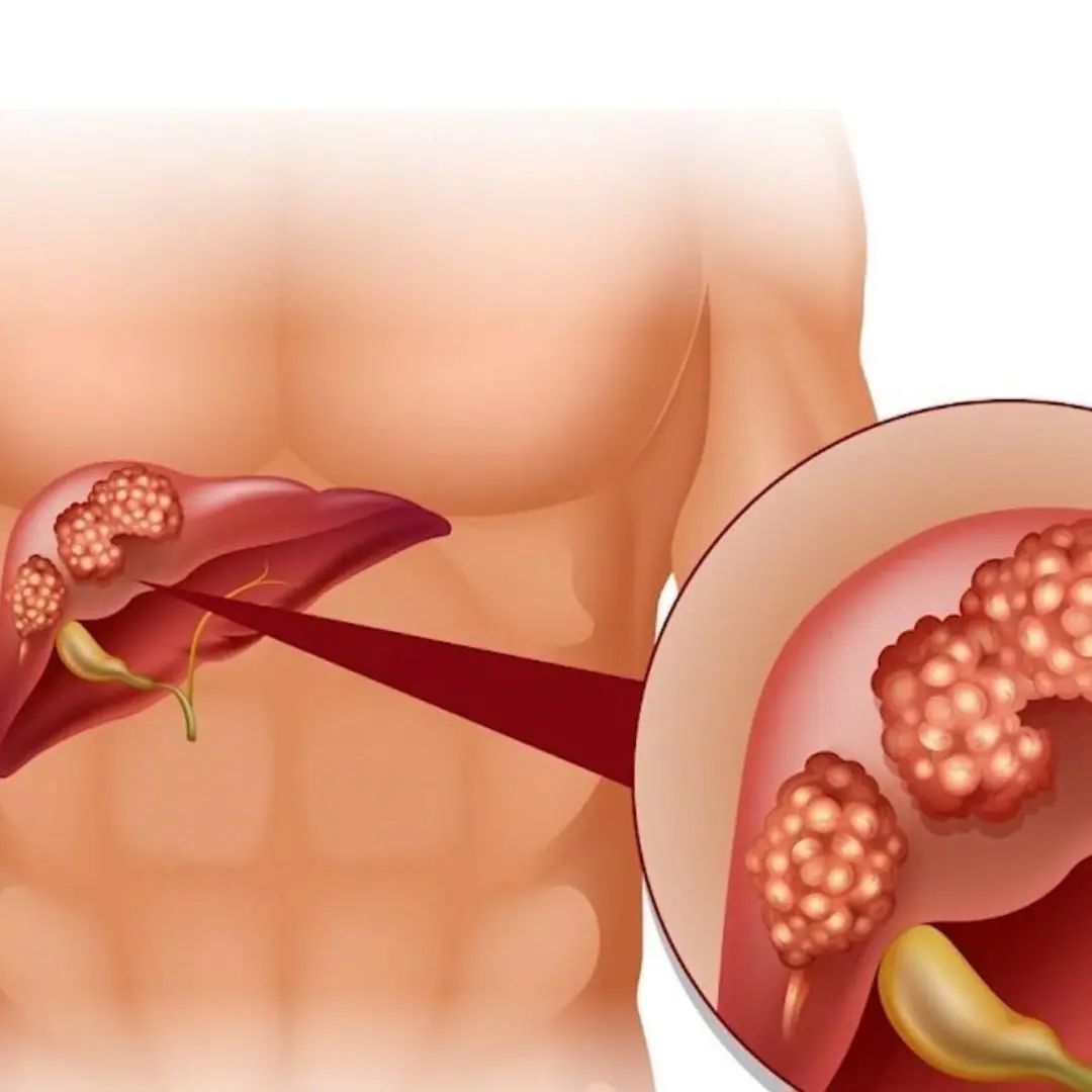 20 Early Warning Signs Your Body May Be Showing That Deserve Medical Attention