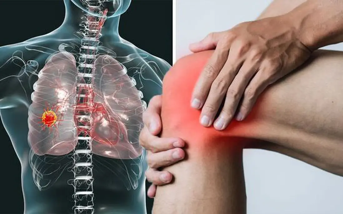 4 Unusual Signs in Your Legs That Could Be War.ning Signs of Lu.ng Can.cer