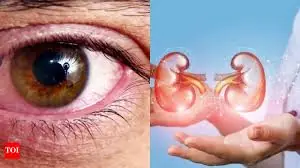 10 Signs You Should Never Ignore: Your Kidneys Could Be at Risk