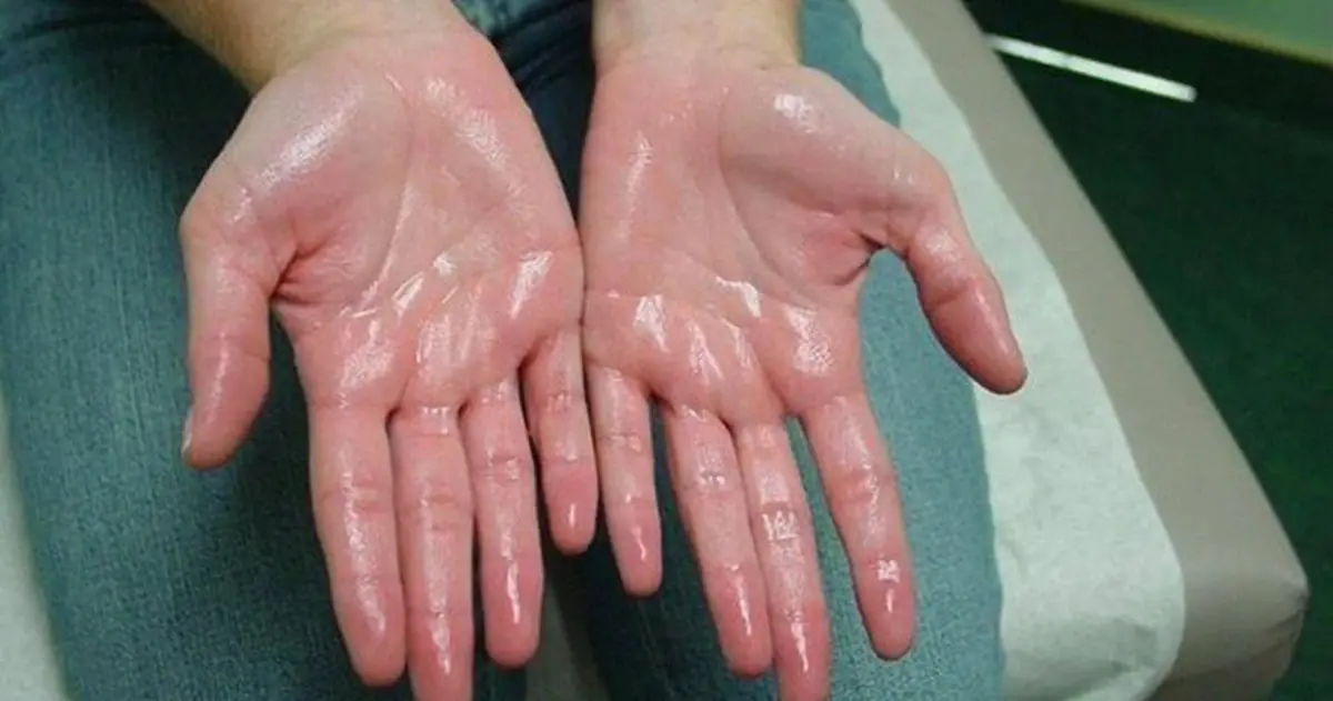 Doctors Warn: If You Notice These 5 Signs on Your Hands, It May Be Time to Check Your Kid.neys
