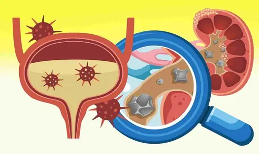 4 Drinks Doctors Recommend Limiting to Help Protect Your Kidneys