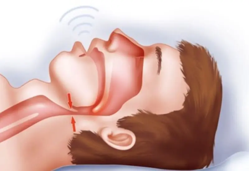 What Causes Excessive Drooling at Night? Here Are 6 Potential Explanations