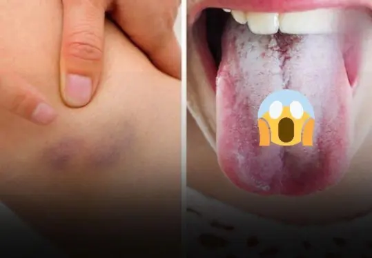 11 Signs Your Body Is Giving You Important Alerts
