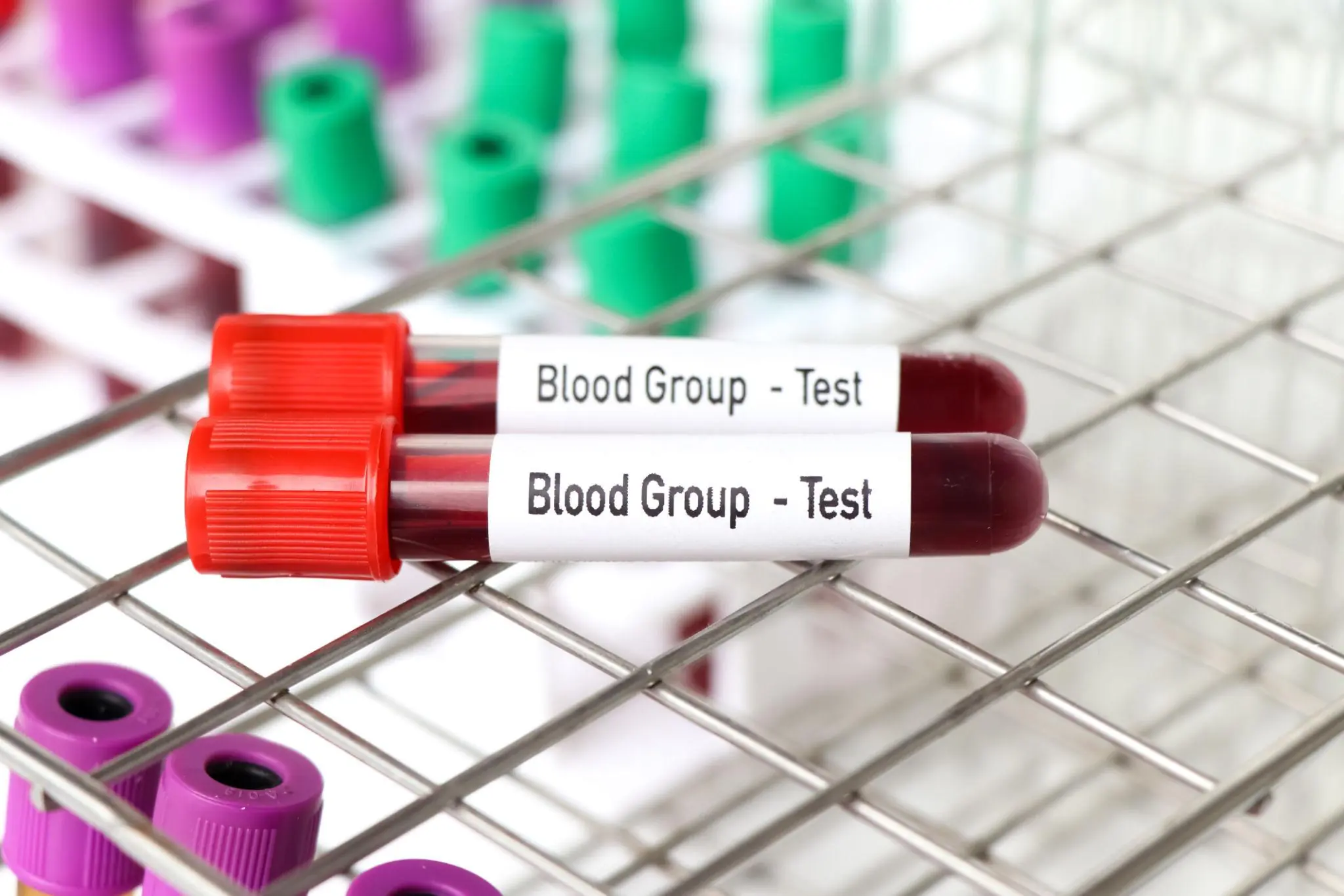 What Your Blood Type May Reveal About Your Health