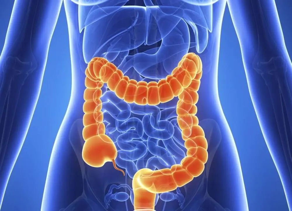 Don't Ignore These 6 Possible Warning Signs of Early Colon Cancer