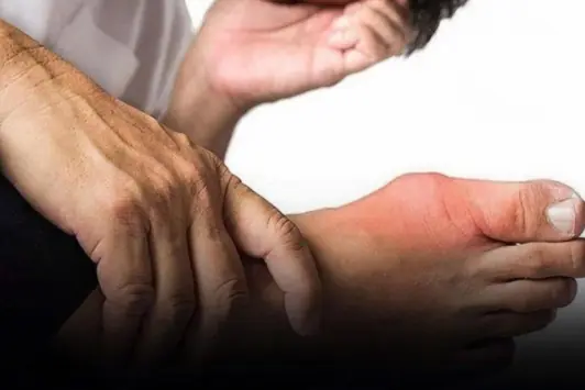 Here are five unusual foot symptoms