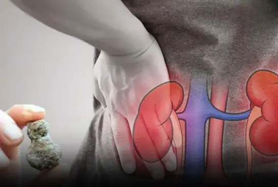 5 Silent Habits That Put Your Kidney Health at R.i.s.k
