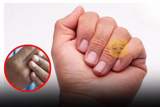 4 changes in fingers that could be signs of lung can.cer
