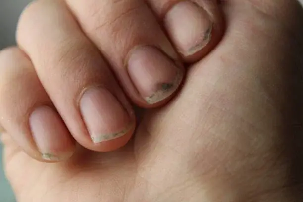 What Do You Call a Person With Nails Like That? The Answer May Surprise You
