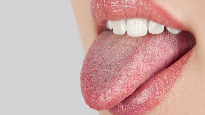 Dry Mouth While Sleeping Isn't Always Random - Here Are 8 Possible Reasons Behind It