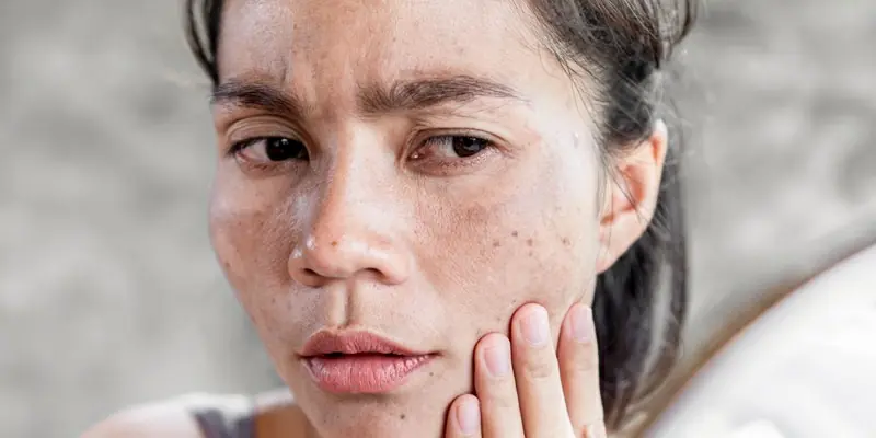 Not All Dark Spots Are Innocent - Here Are 5 Signs Experts Say to Watch For