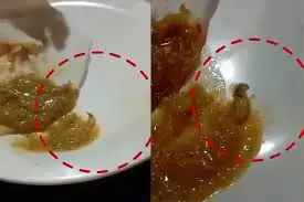Health Alert: 4 Foods That Could Increase Your Risk of Parasite Exposure