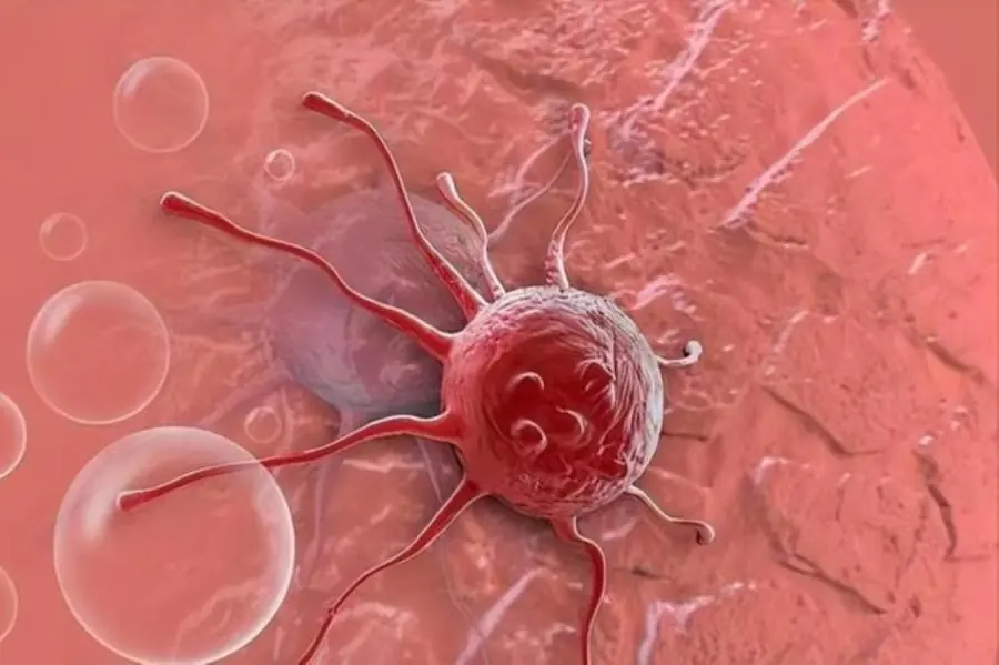 3 Fast-Moving Can.cers That Can Progress Rapidly — And Why Early Detection Matters