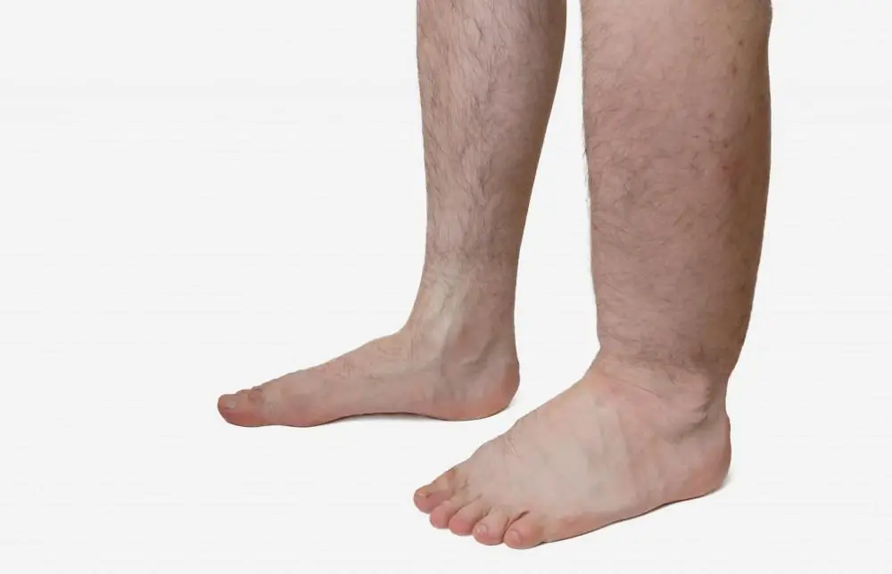 If Your Legs Are Swollen, Don't Ignore These Possible Warning Signs