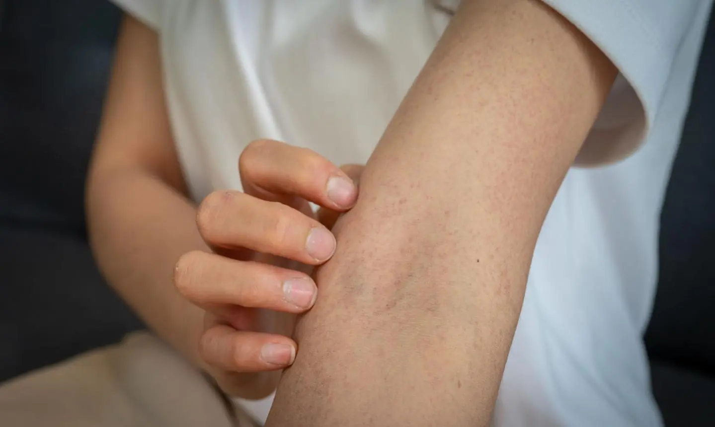 Itchy Skin and Mysterious Bumps: What Your Body May Be Trying to Tell You