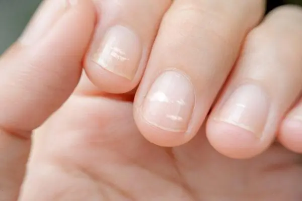 What Do Lines on Your Nails After 40 Really Mean? Experts Explain