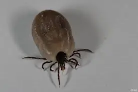 This Tiny Creature Was Hiding in My Son's Hair... Can Anyone Identify It?
