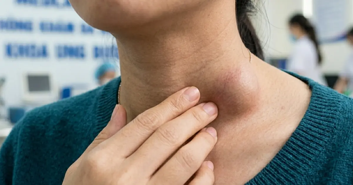 Have You Noticed Bulging Veins in Your Neck? It Could Be Worth Paying Attention