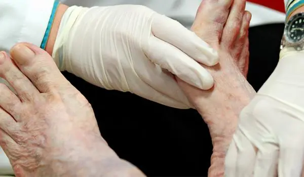 Your Feet May Be Telling You More About Your Blo.od Sugar Than You Realize