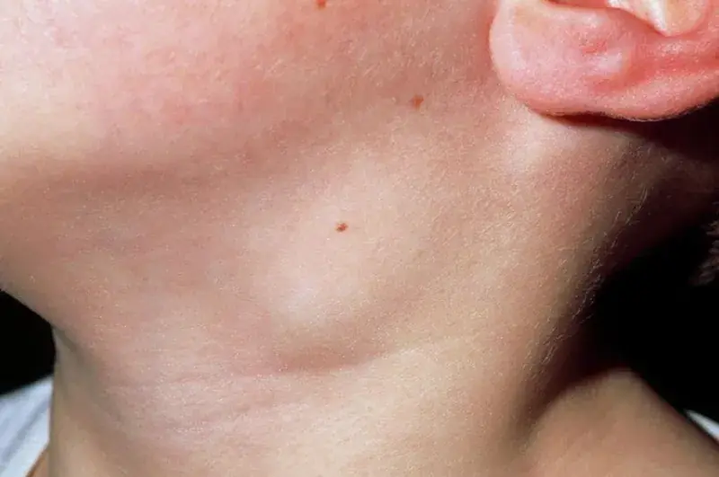Your Neck Can Sometimes Reflect Changes in Your Health - Here Are 3 Signs to Watch For