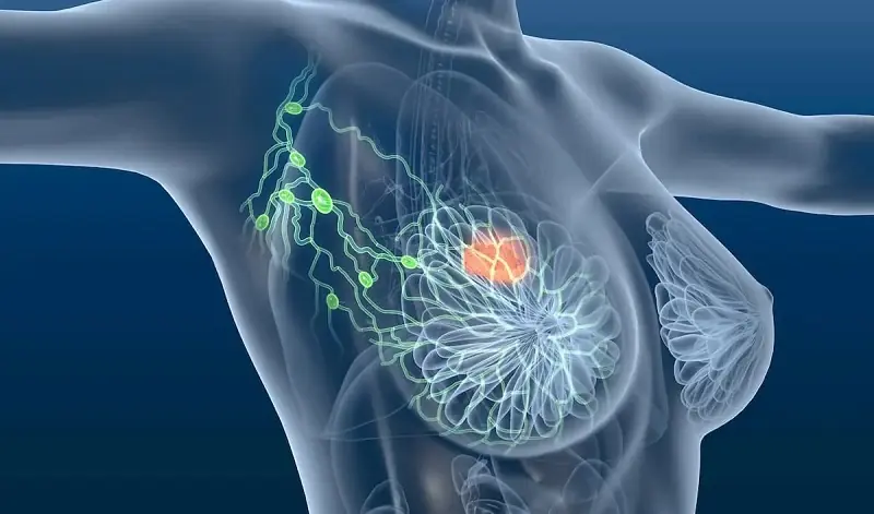 Many Breast Changes Are Normal But These 10 Symptoms Deserve Attention