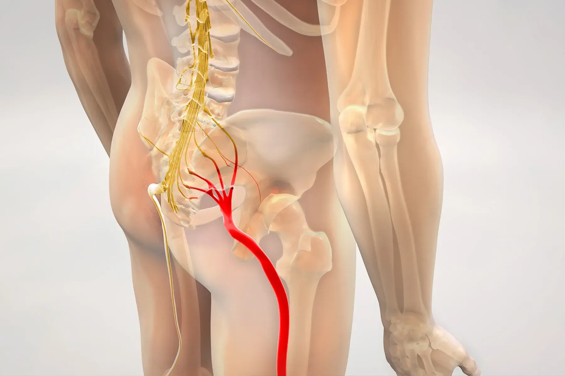 Sciatica Making Everyday Tasks Difficult? Here Are Some Natural Solutions Worth Trying