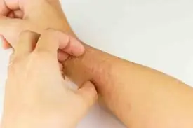 Doctors Reveal 9 Kinds of Itching That Could Signal More Than a Skin Problem