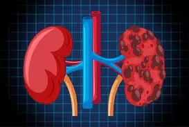 Your Body Often Warns You Before Kidney Problems Become Serious—Watch for These 8 Signs