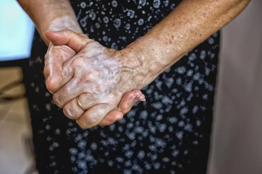 Your Hand Veins May Reveal More About Your Health Than You Think