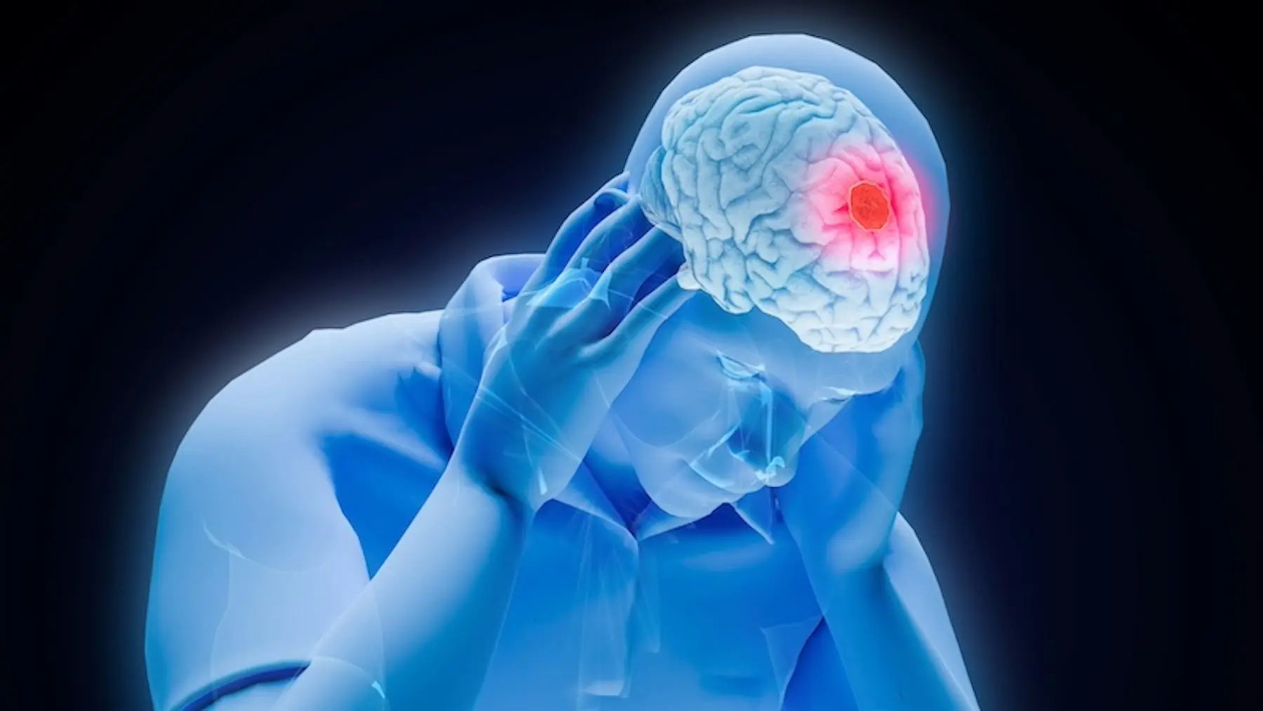 Different Headache Patterns Can Point to Different Health Issues