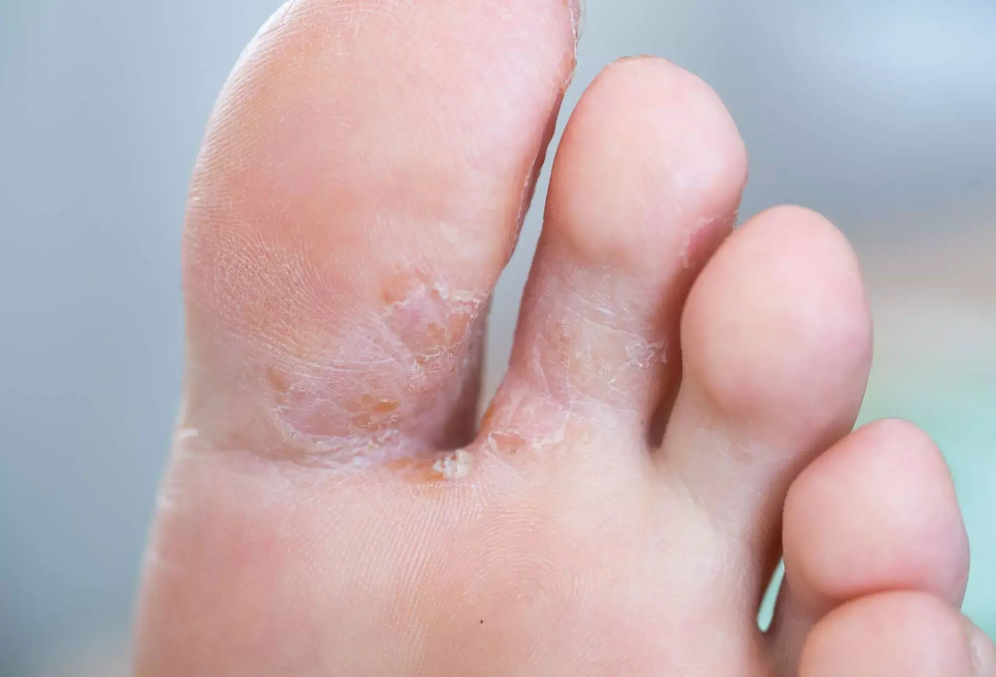 These 7 Common Symptoms Could Be More Important Than You Realize