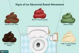 Different Stool Colors, Different Messages: What Your Body May Be Telling You
