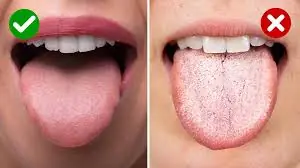 Noticing a White Coating on Your Tongue? Here's What It Could Mean