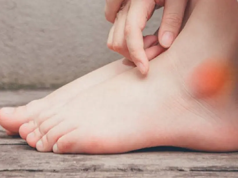 Don't Ignore These 4 Leg Symptoms – They May Indicate a More Serious Medical Issue