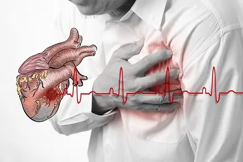 Healthy Habits for Stroke Prevention: 3 Things to Avoid After Meals and 4 Before Bed