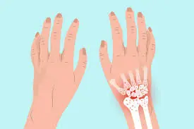 Tingling Fingers May Seem Harmless—But Sometimes They Signal Something More