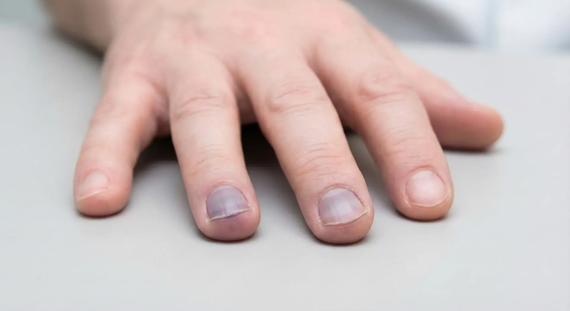 These 9 Nail Changes May Offer Early Clues About What's Happening Inside Your Body