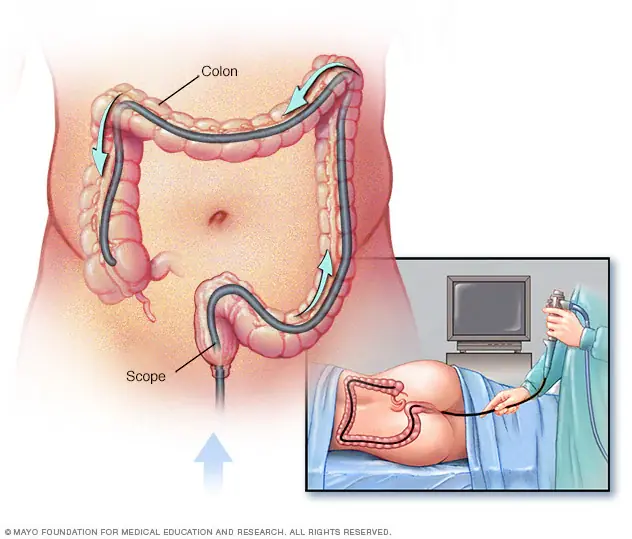 Before Your Colonoscopy Appointment, There Are Several Things Your Doctor Should Know
