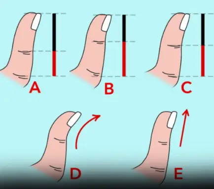 The Secrets Your Thumb Shape Reveals