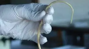 Many People Eat These 4 Foods Without Realizing They May Carry Parasites