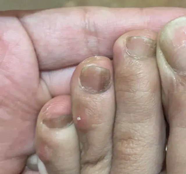 5 Differences in Your Feet That May Be War.ning Signs of Can.cer