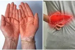 Recurring Redness, Itching, and Odor Can Sometimes Indicate an Underlying Condition