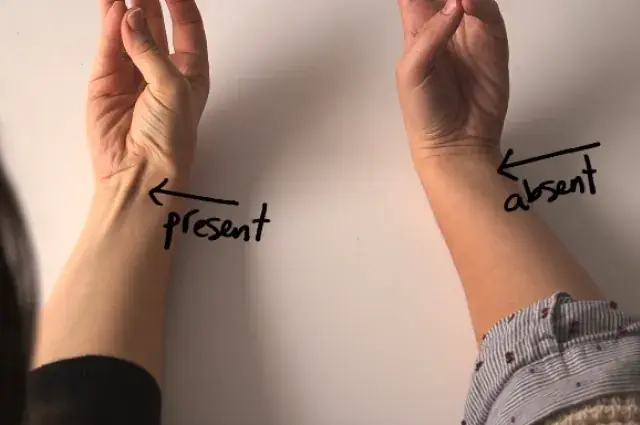 Your Body Carries Traces of Evolution — And Your Tendons Are Part of the Story