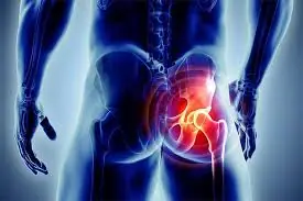 If Your Hip Hurts, Your Body May Be Trying to Tell You Something Important