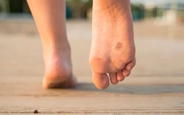 Your Feet Often Reflect Your Overall Well-Being – Here Are 10 Signs to Watch For
