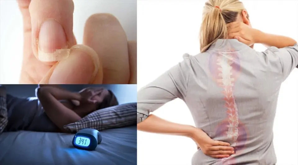 6 Common Foods That May Reduce Calcium Levels and Affect Bone Health