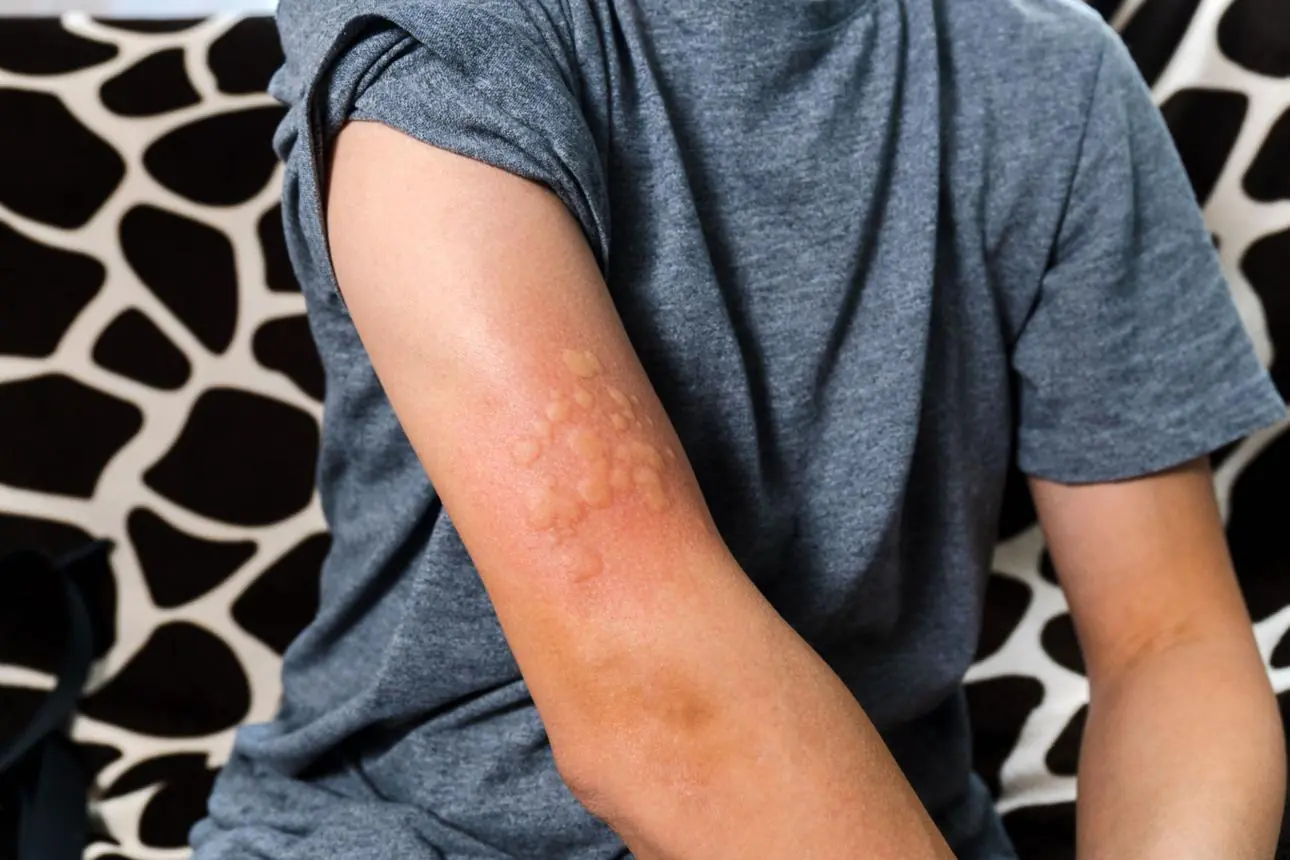 6 Skin Changes You Should Never Ignore, According to Health Experts