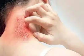 Your Body May Be Sending Clues Through These 9 Unusual Itching Symptoms