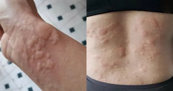 You Sleep With a ___ Every Night—But Do You Know What It Does to Your Body?